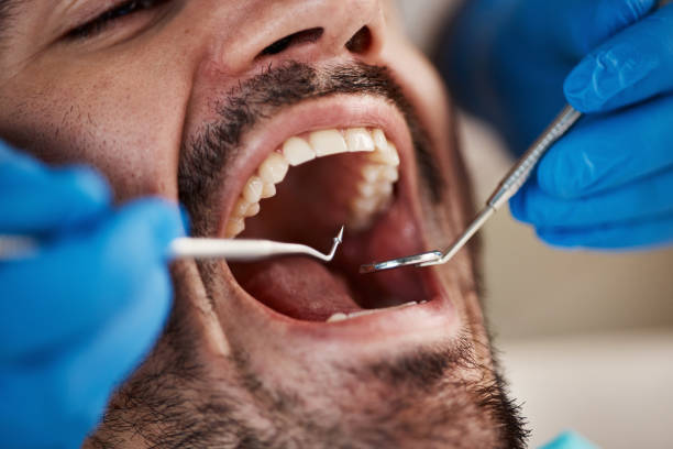 Tooth Infection Emergency Dentist in HI